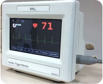 Cardiac Trigger Monitor